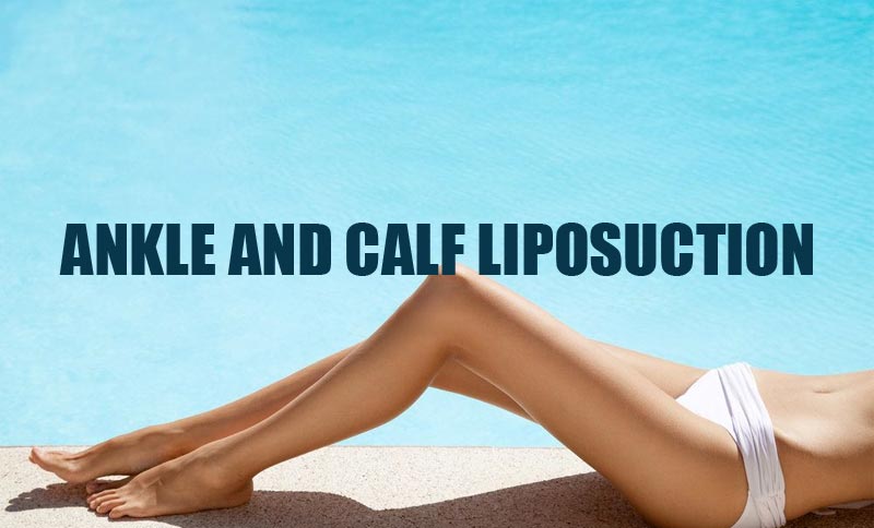 ankle and calf liposuction