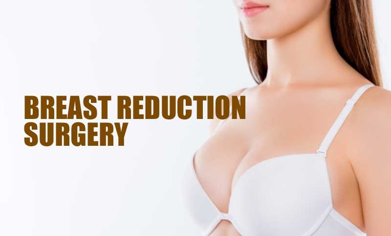 breast reduction 