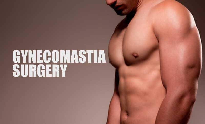 gynecomastia