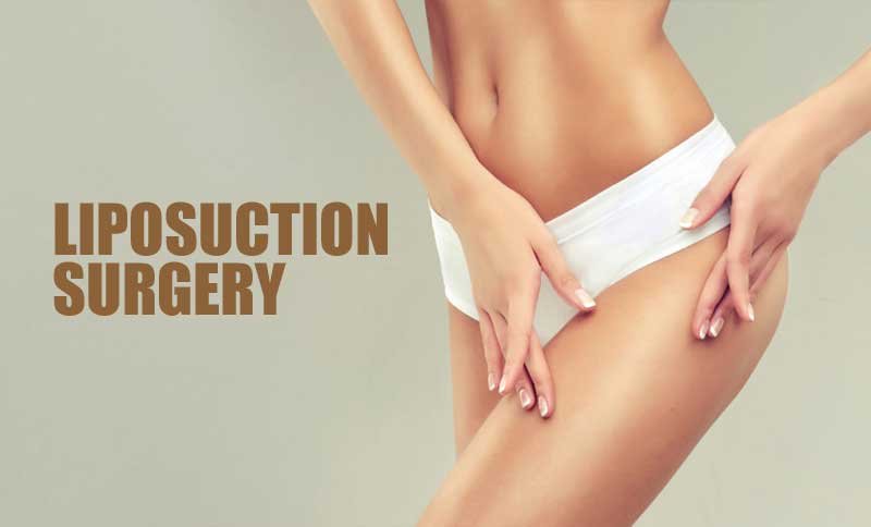 liposuction