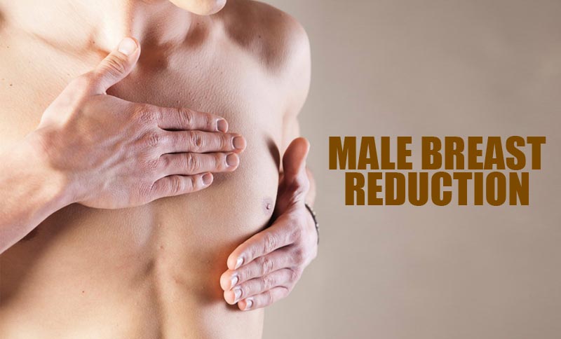 Male Breast Reduction in Surat and Gujarat